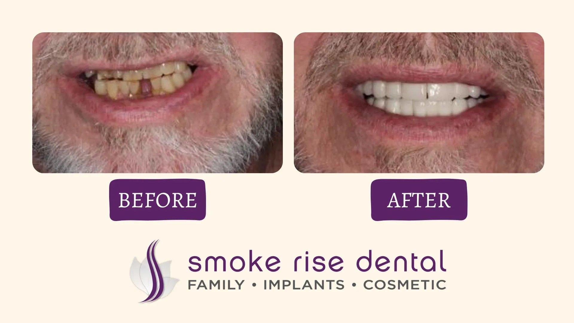 Before after Cosmetic Dentist 1